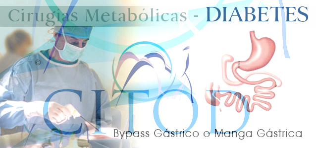 Cirugia de Diabetes